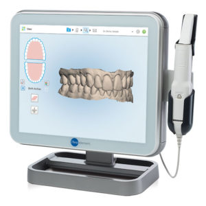 Rappresentazione in 3D della bocca grazie allo scanner intraorale.