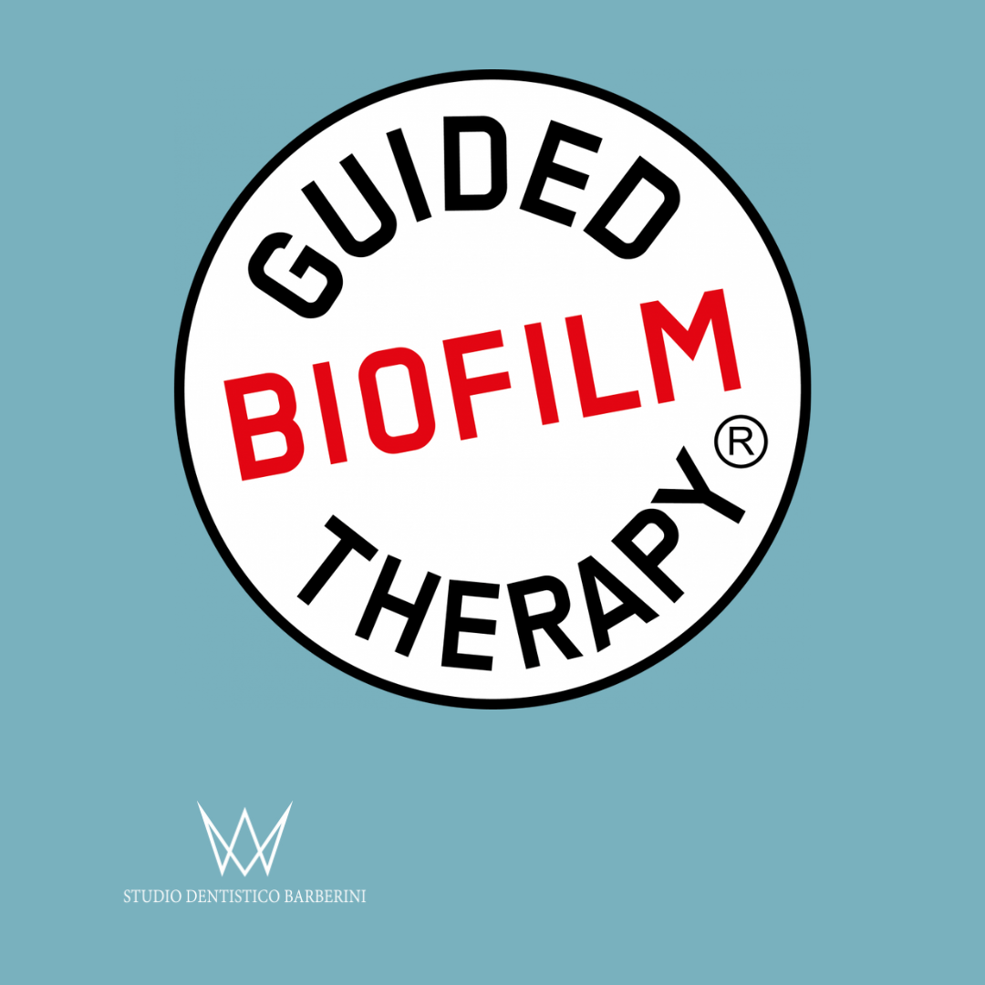 GBT – Guided Biofilm Therapy